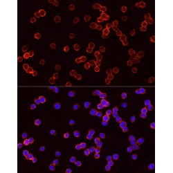 Tumor Susceptibility Gene 101 (TSG101) Antibody