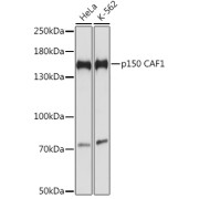 Western blot analysis of various lysates using p150 CAF1 Antibody at 1/1000 dilution. Secondary antibody: HRP-conjugated Goat anti-Rabbit IgG (H+L) at 1/10000 dilution. Lysates/proteins: 25 µg per lane. Blocking buffer: 3% nonfat dry milk in TBST. Exposure time: 5s.
