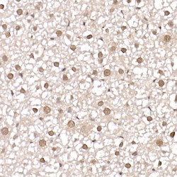 Coactivator-Associated Arginine Methyltransferase 1 (CARM1) Antibody