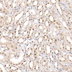 Coactivator-Associated Arginine Methyltransferase 1 (CARM1) Antibody