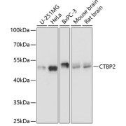 abx001840