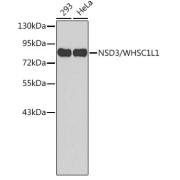 Western blot analysis of various lysates using NSD3/WHSC1L1 Antibody. Secondary antibody: HRP-conjugated Goat anti-Rabbit IgG (H+L) at 1/10000 dilution. Lysates/proteins: 25 µg per lane. Blocking buffer: 3% nonfat dry milk in TBST.