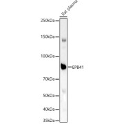 Western blot analysis of various lysates using EPB41 Antibody at 1/1000 dilution. Secondary antibody: HRP-conjugated Goat anti-Rabbit IgG (H+L) at 1/10000 dilution. Lysates/proteins: 25 µg per lane. Blocking buffer: 3% nonfat dry milk in TBST. 