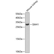 Western blot analysis of lysates from mouse kidney, using SIAH1 Antibody at 1/1000 dilution. Secondary antibody: HRP-conjugated Goat anti-Rabbit IgG (H+L) at 1/10000 dilution. Lysates/proteins: 25 µg per lane. Blocking buffer: 3% nonfat dry milk in TBST.