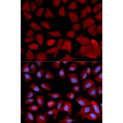 26S Proteasome Regulatory Subunit 6B (PSMC4) Antibody
