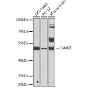 Western blot analysis of various lysates using CaMKII Antibody at 1/1000 dilution. Secondary antibody: HRP-conjugated Goat anti-Rabbit IgG (H+L) at 1/10000 dilution. Lysates/proteins: 25 µg per lane. Blocking buffer: 3% nonfat dry milk in TBST. Exposure time: 90s.