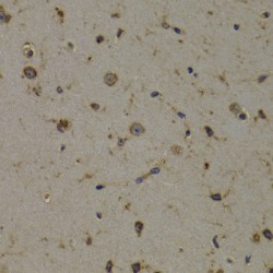 Eukaryotic Translation Elongation Factor 1 Delta (EEF1D) Antibody