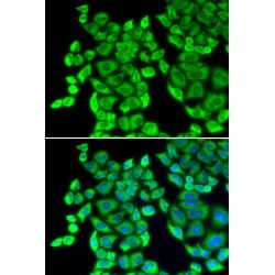 Eukaryotic Translation Elongation Factor 1 Delta (EEF1D) Antibody