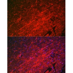 Heat Shock Protein Beta 8 (HSPB8) Antibody