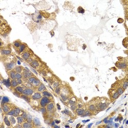 Glycogen Synthase 1, Muscle (GYS1) Antibody