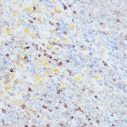 Neural Precursor Cell Expressed, Developmentally Down-Regulated 9 (NEDD9) Antibody