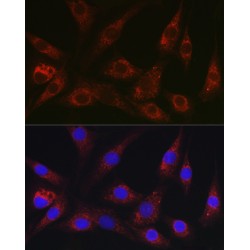 Neural Precursor Cell Expressed, Developmentally Down-Regulated 9 (NEDD9) Antibody