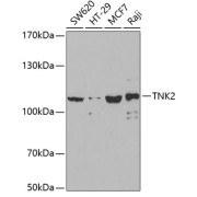 Western blot analysis of various lysates using TNK2 Antibody at 1/1000 dilution. Secondary antibody: HRP-conjugated Goat anti-Rabbit IgG (H+L) at 1/10000 dilution. Lysates/proteins: 25 µg per lane. Blocking buffer: 3% nonfat dry milk in TBST.
