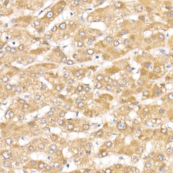 Tyrosine Kinase, Non Receptor 2 / ACK1 (TNK2) Antibody