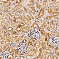 Tyrosine Kinase, Non Receptor 2 / ACK1 (TNK2) Antibody