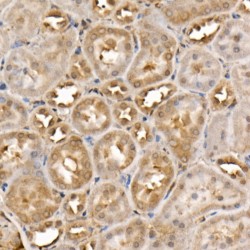 Tyrosine Kinase, Non Receptor 2 / ACK1 (TNK2) Antibody