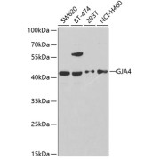 Western blot analysis of lysates from Rat liver using GJA4 Antibody at 1/1000 dilution. Secondary antibody: HRP-conjugated Goat anti-Rabbit IgG (H+L) at 1/10000 dilution. Lysates/proteins: 25 µg per lane. Blocking buffer: 3% nonfat dry milk in TBST. Exposure time: 30s.