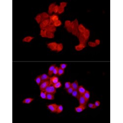 Transcription Factor p65 / NFKB3 (RELA) Antibody