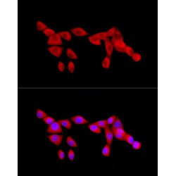 Transcription Factor p65 / NFKB3 (RELA) Antibody