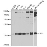 Western blot analysis of various lysates using SKP1 Antibody at 1/1000 dilution. Secondary antibody: HRP-conjugated Goat anti-Rabbit IgG (H+L) at 1/10000 dilution. Lysates/proteins: 25 µg per lane. Blocking buffer: 3% nonfat dry milk in TBST.