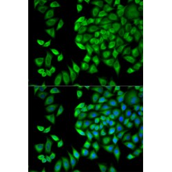 WNK Lysine Deficient Protein Kinase 1 (WNK1) Antibody