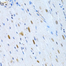 Microtubule Associated Protein 2 (MAP2) Antibody
