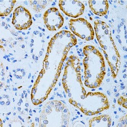 Microtubule Associated Protein 2 (MAP2) Antibody