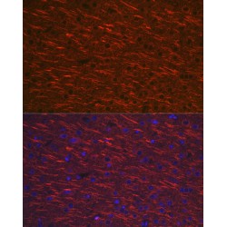 Microtubule Associated Protein 2 (MAP2) Antibody