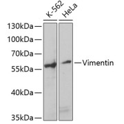 Western blot analysis of various lysates using Vimentin Antibody at 1/1000 dilution. Secondary antibody: HRP-conjugated Goat anti-Rabbit IgG (H+L) at 1/10000 dilution. Lysates/proteins: 25 µg per lane. Blocking buffer: 3% nonfat dry milk in TBST. Exposure time: 90s.