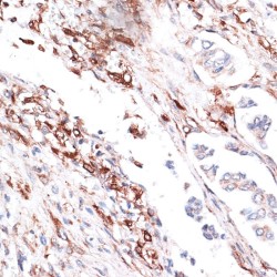 Vimentin (VIM) Antibody