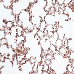 Vimentin (VIM) Antibody