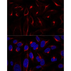 Vimentin (VIM) Antibody