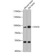 Western blot analysis of various lysates using STAT4 Antibody at 1/3000 dilution. Secondary antibody: HRP-conjugated Goat anti-Rabbit IgG (H+L) at 1/10000 dilution. Lysates/proteins: 25 µg per lane. Blocking buffer: 3% nonfat dry milk in TBST. Exposure time: 90s.