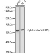 Western blot analysis of various lysates using Cytokeratin 5 Antibody at 1/1000 dilution. Secondary antibody: HRP-conjugated Goat anti-Rabbit IgG (H+L) at 1/10000 dilution. Lysates/proteins: 25 µg per lane. Blocking buffer: 3% nonfat dry milk in TBST. Exposure time: 1s.