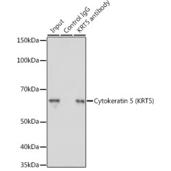 Keratin, Type II Cytoskeletal 5 (KRT5) Antibody