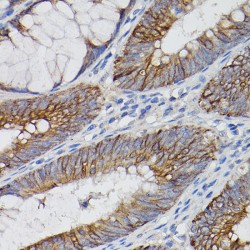Interleukin 18 Receptor 1 (IL18R1) Antibody