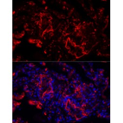 Elastin (ELN) Antibody