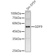 Western blot analysis of lysates from SH-SY5Y cells, using GDF9 Antibody at 1/2000 dilution. Secondary antibody: HRP-conjugated Goat anti-Rabbit IgG (H+L) at 1/10000 dilution. Lysates/proteins: 25 µg per lane. Blocking buffer: 3% nonfat dry milk in TBST. Exposure time: 3s.