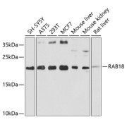 Western blot analysis of various lysates using RAB18 Antibody at 1/1000 dilution. Secondary antibody: HRP-conjugated Goat anti-Rabbit IgG (H+L) at 1/10000 dilution. Lysates/proteins: 25 µg per lane. Blocking buffer: 3% nonfat dry milk in TBST. Exposure time: 90s.