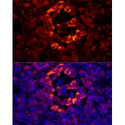 Islet Amyloid Polypeptide (IAPP) Antibody