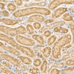 Carnitine Palmitoyltransferase 2, Mitochondrial (CPT2) Antibody