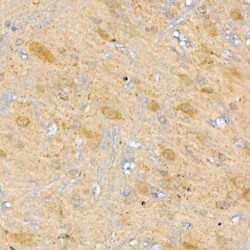Carnitine Palmitoyltransferase 2, Mitochondrial (CPT2) Antibody