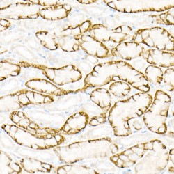 Aquaporin 4 (AQP4) Antibody