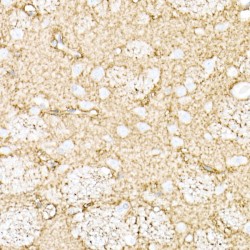 Aquaporin 4 (AQP4) Antibody