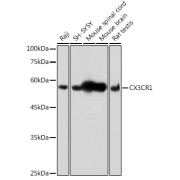 Western blot analysis of various lysates using CX3CR1 Antibody at 1/500 dilution. Secondary antibody: HRP-conjugated Goat anti-Rabbit IgG (H+L) at 1/10000 dilution. Lysates/proteins: 25 µg per lane. Blocking buffer: 3% nonfat dry milk in TBST. Exposure time: 1s.