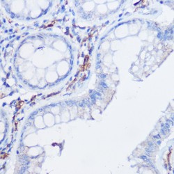 Chemokine C-X3-C-Motif Motif Receptor 1 (CX3CR1) Antibody