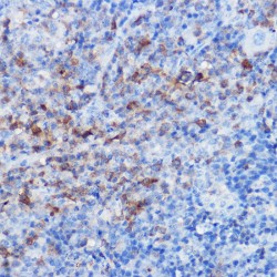 Chemokine C-X3-C-Motif Motif Receptor 1 (CX3CR1) Antibody