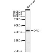 Western blot analysis of lysates from Rat brain, using DRD1 Antibody at 1/600 dilution. Secondary antibody: HRP-conjugated Goat anti-Rabbit IgG (H+L) at 1/10000 dilution. Lysates/proteins: 25 µg per lane. Blocking buffer: 3% nonfat dry milk in TBST. Exposure time: 0.2s.