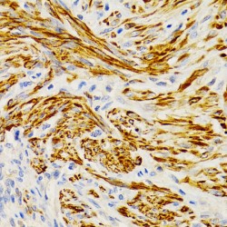 Ectodysplasin-A (EDA) Antibody