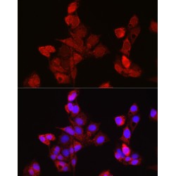 Ectodysplasin-A (EDA) Antibody